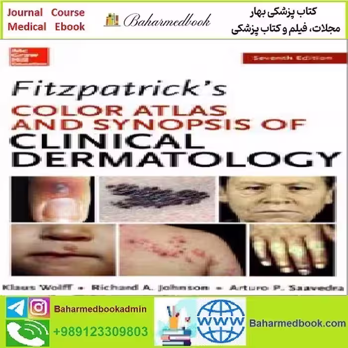 Fitzpatrick’s Color Atlas and Synopsis of Clinical Dermatology
