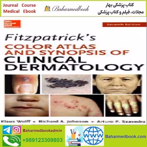 Fitzpatrick’s Color Atlas and Synopsis of Clinical Dermatology