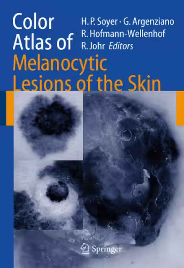 خرید و دانلود نسخه کامل کتاب Color Atlas of Melanocytic Lesions of the Skin