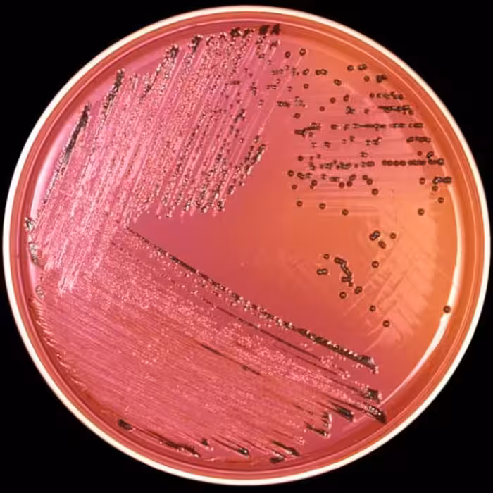 سالمونلا انتریکا  Salmonella enterica subsp. enterica