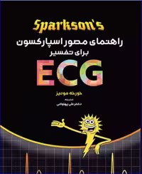 کتاب راهنمای مصور اسپارکسون برای تفسیر ECG