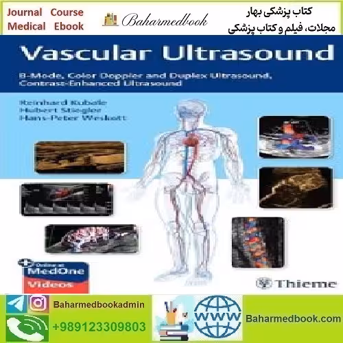 Vascular Ultrasound B Mode Color Doppler and Duplex Ultrasou