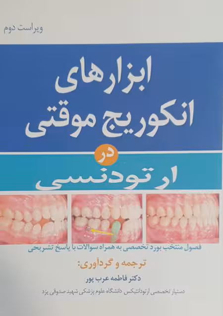 ابزارهای انکوریج موقتی در ارتودنسی