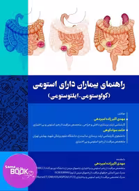 راهنمای بیماران دارای استومی (کولوستومی – ایلئوستومی)