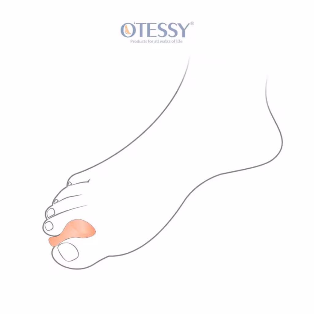 پد لا انگشتی سیلیکونی مدل TFO1 اتسی OTESSY