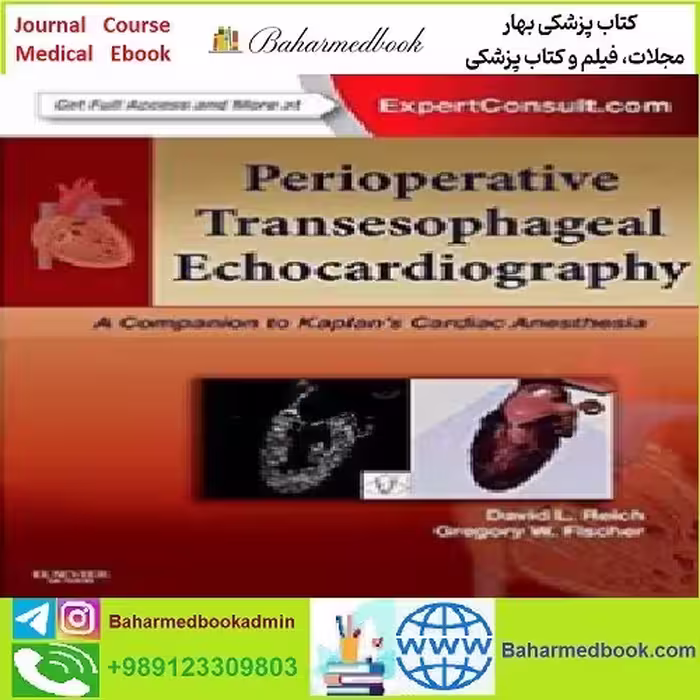 Perioperative Transesophageal Echocardiography TRUE PDF pr