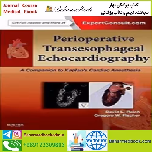Perioperative Transesophageal Echocardiography TRUE PDF pr