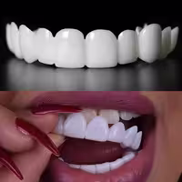 لمینت دندان دو فک مدل Snap on Smile