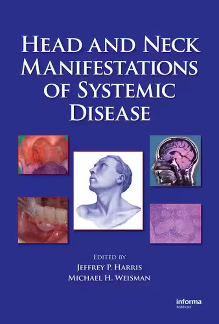 خرید و دانلود نسخه کامل کتاب Head and Neck Manifestations of Systemic Disease