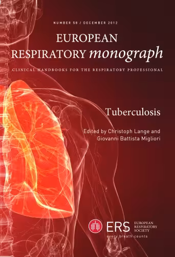 خرید و دانلود نسخه کامل کتاب Tuberculosis