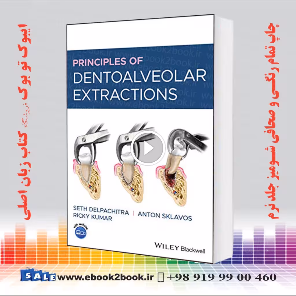 Principles of Dentoalveolar Extractions