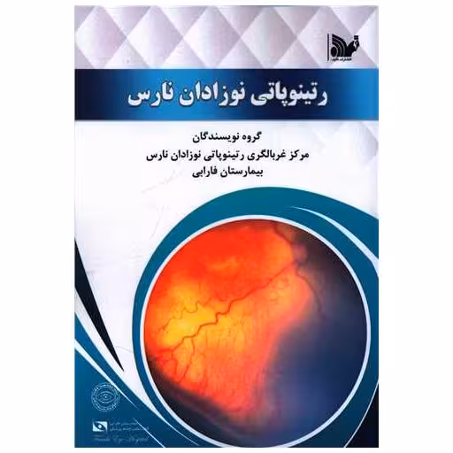 کتاب رتینوپاتی نوزادان نارس اثر جمعی از نویسندگان