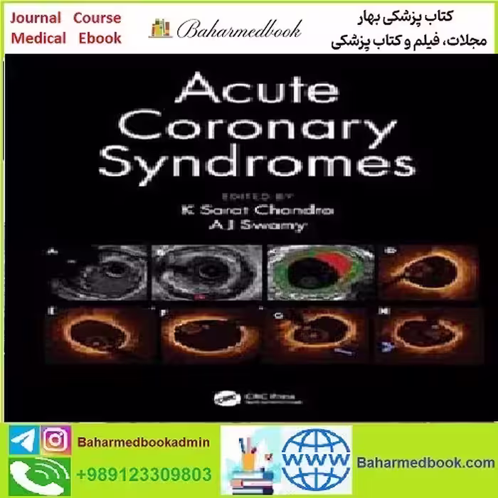 Acute Coronary Syndromes TRUE PDF price 1€ - کتاب پزشکی بهار