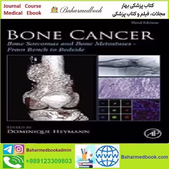Bone Cancer Bone Sarcomas and Bone Metastases TRUE PDF p