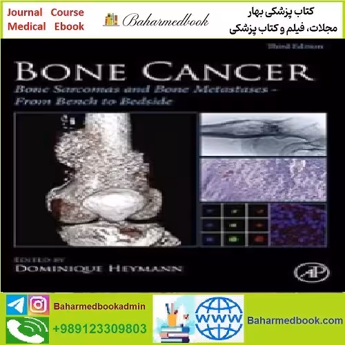 Bone Cancer Bone Sarcomas and Bone Metastases TRUE PDF p