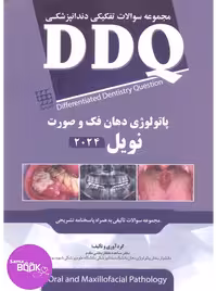DDQ پاتولوژی دهان، فک و صورت نویل 2024 (مجموعه سوالات تفکیکی دندانپزشکی)
