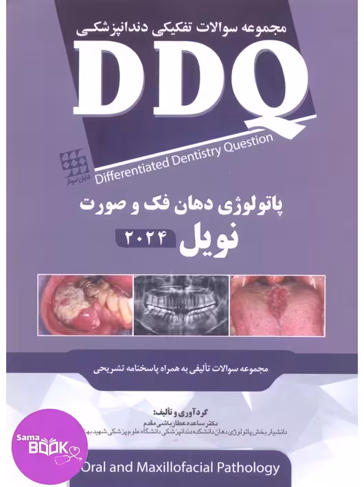 DDQ پاتولوژی دهان، فک و صورت نویل 2024 (مجموعه سوالات تفکیکی دندانپزشکی)
