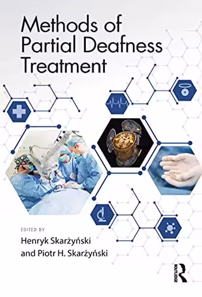 خرید و دانلود نسخه کامل کتاب Methods of Partial Deafness Treatment