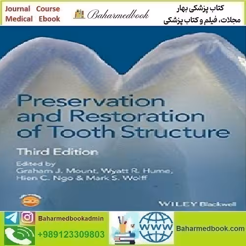 Preservation and Restoration of Tooth Structure 2016