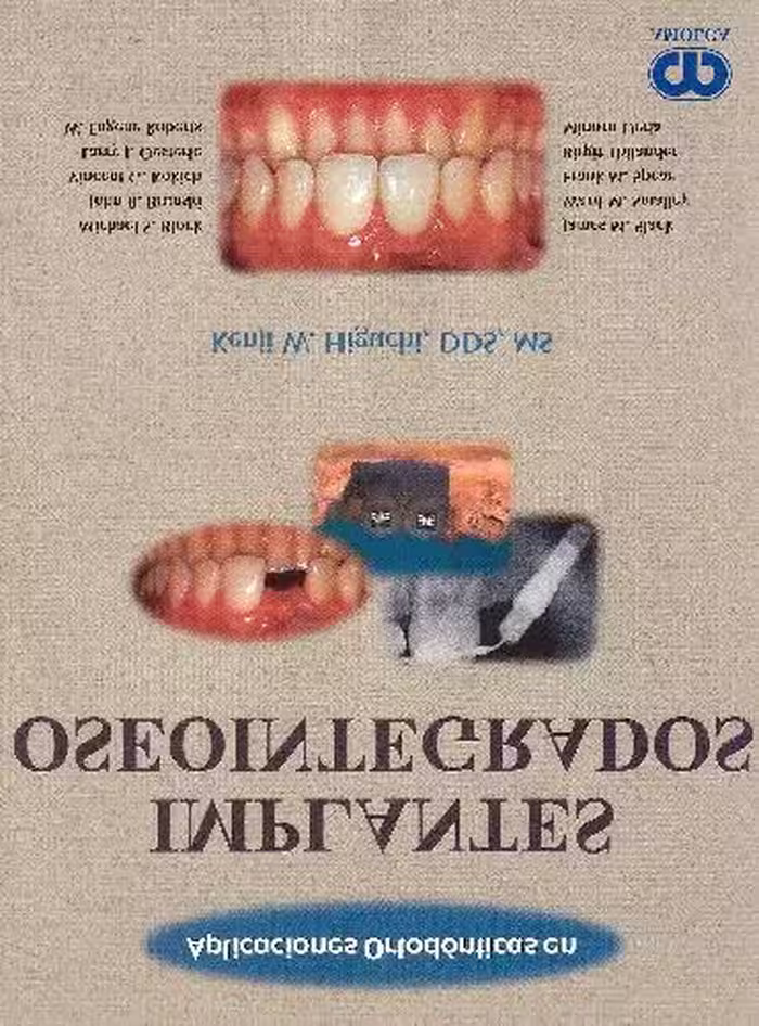 خرید و دانلود نسخه کامل کتاب Aplicaciones Ortodвnticas en Implantes