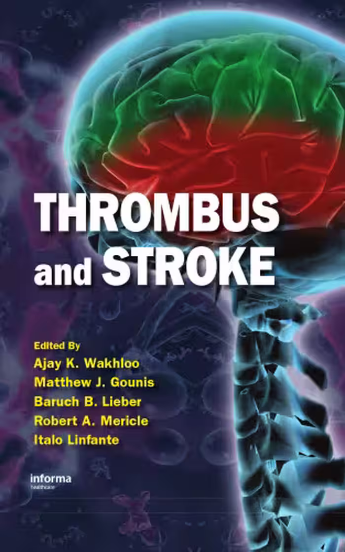 خرید و دانلود نسخه کامل کتاب Thrombus and Stroke (Neurological Disease and Therapy)