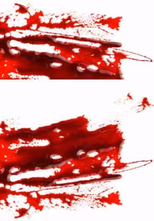 [PDF] دانلود کتاب Hematology - Science And Practice, 2012