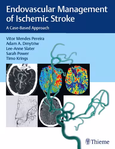 خرید و دانلود نسخه کامل کتاب Endovascular Management of Ischemic Stroke: A Case-based Approach