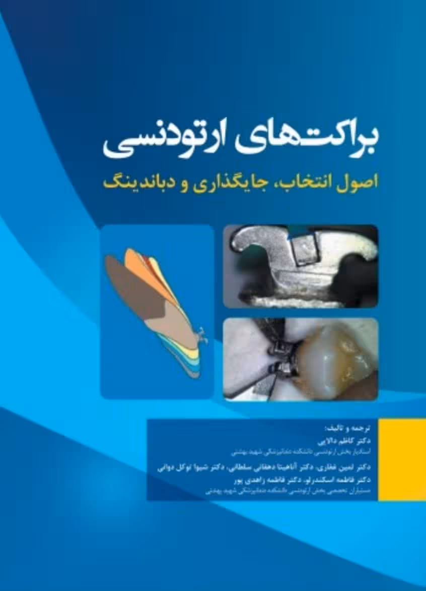 براکت های ارتودنسی اصول انتخاب، جایگذاری و دباندینگ