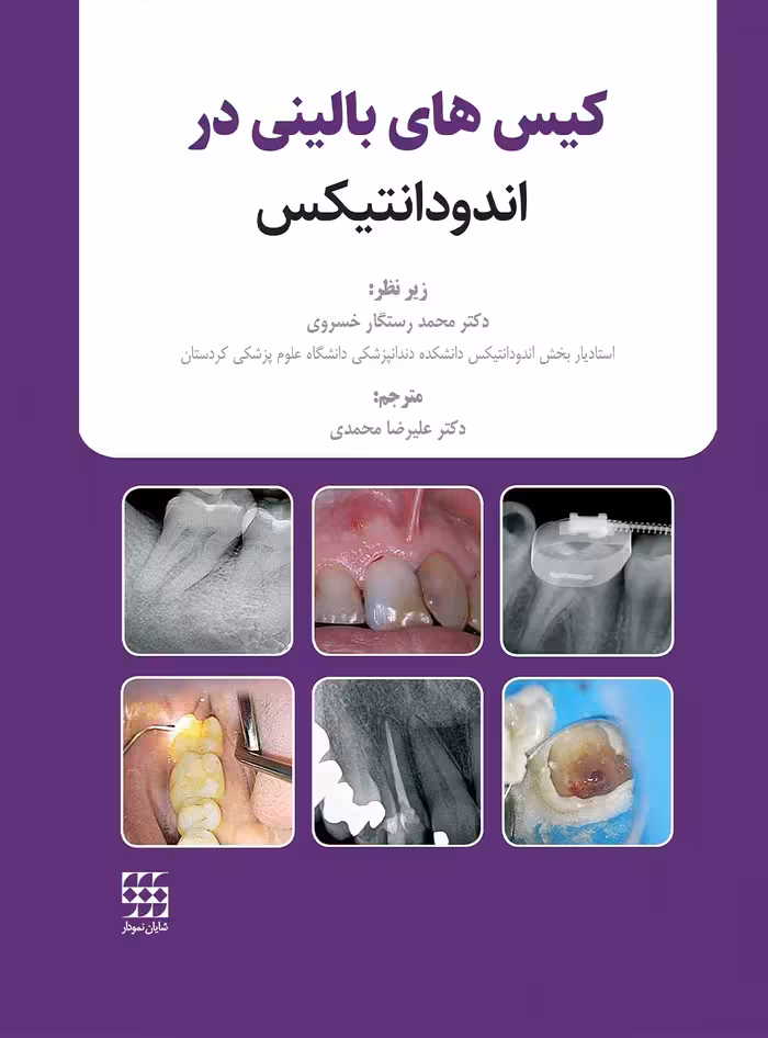 کیس های بالینی در اندودانتیکس