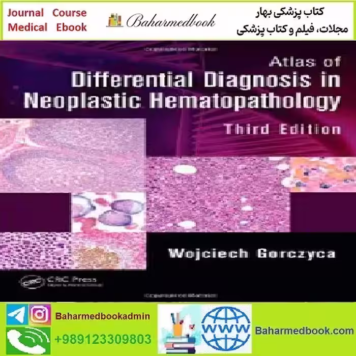 Atlas of Differential Diagnosis in Neoplastic Hematopathology