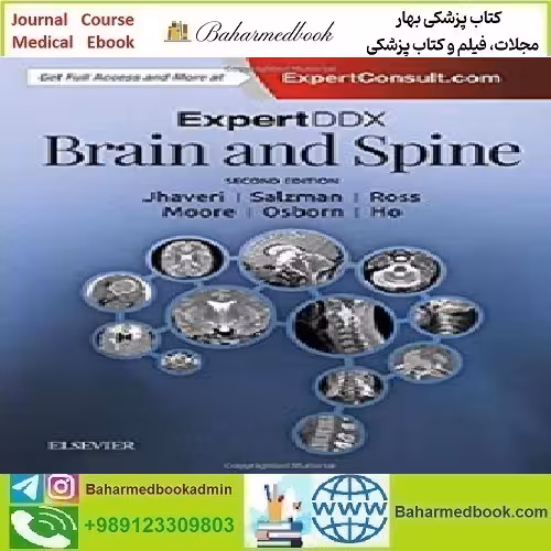 ExpertDDx Brain and Spine 2018 TRUE PDF price 1€ - کتاب پزشکی بهار