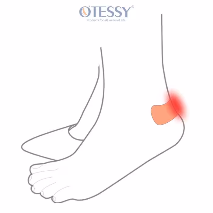 محافظ سیلیکونی پشت پا OTESSY