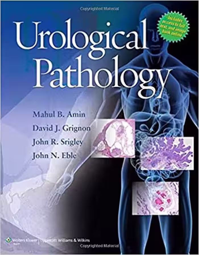 󾕇 دانلود کتاب Urological Pathology, 2013 - دانلود کتاب های دانشگاهی