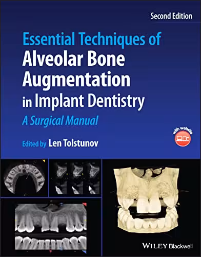 خرید و دانلود نسخه کامل کتاب Essential Techniques of Alveolar Bone Augmentation in Implant Dentistry: A Surgical Manual