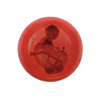 ملد نوزاد و کالسکه کد 883