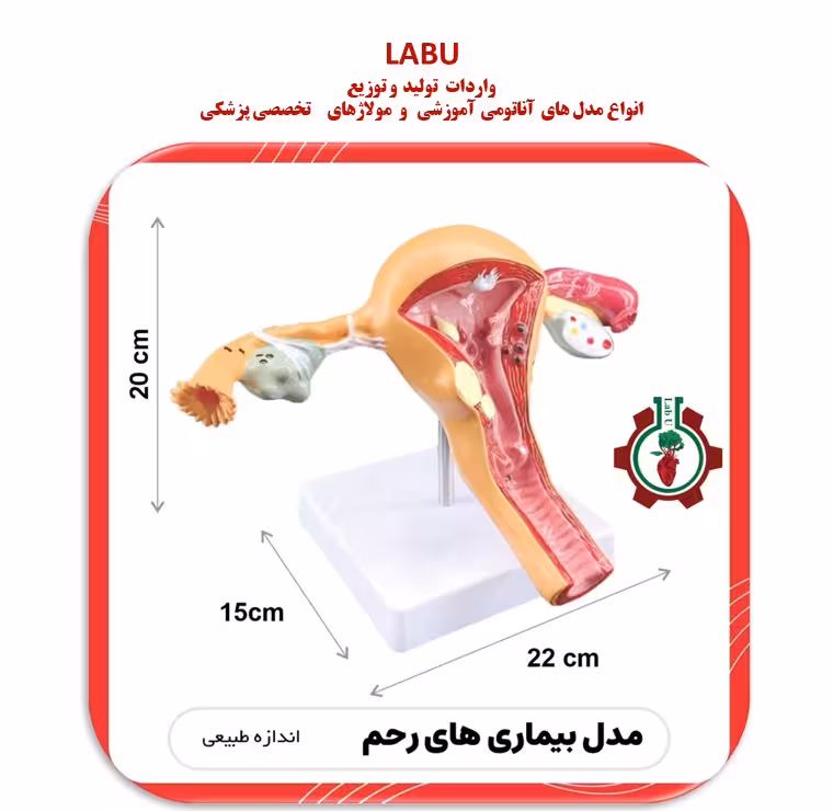 مولاژ بیماری های رحم