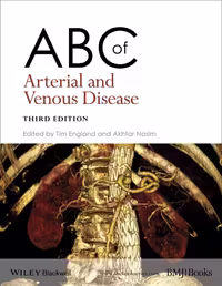 خرید و دانلود نسخه کامل کتاب ABC of Arterial and Venous Disease