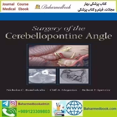 Surgery of the Cerebellopontine Angle 2010 TRUE PDF price 1€ - کتاب پزشکی بهار