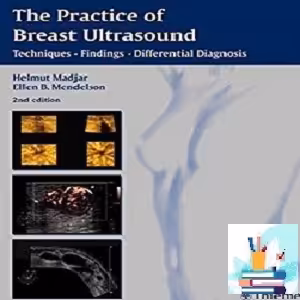 The Practice of Breast Ultrasound TRUE PDF price 1€