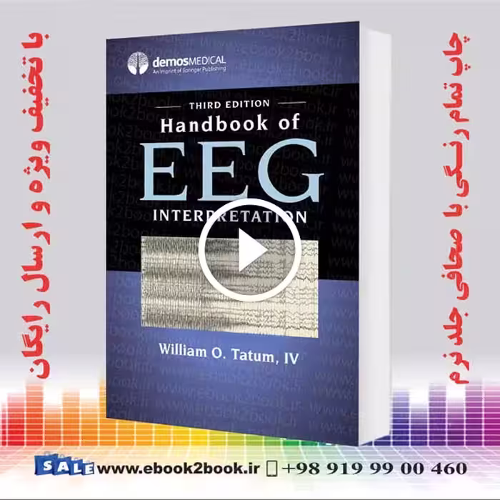 Handbook of EEG Interpretation 3rd Edition
