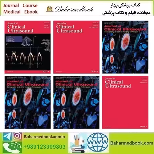 Journal of Clinical Ultrasound 2024 Full Archives TRUE PDF