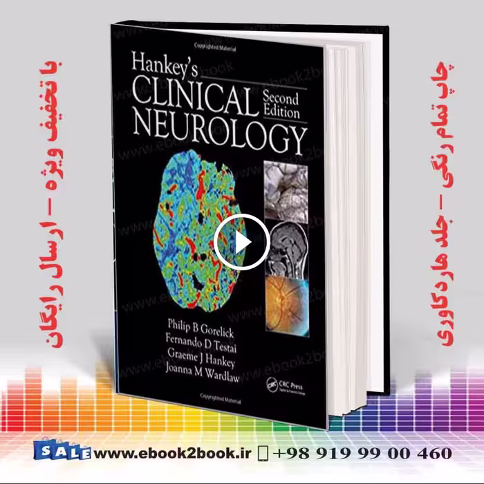 Hankey’s Clinical Neurology, 2nd Edition