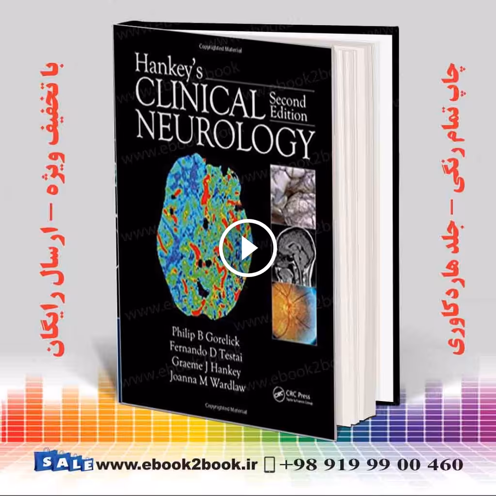 Hankey’s Clinical Neurology, 2nd Edition