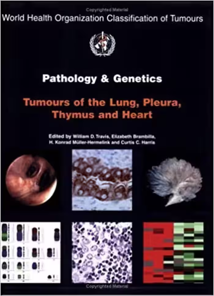 󾕇 دانلود کتاب Pathology &amp; Genetics Of Tumours Of The Lung, Thymus And Heart, 2004 - دانلود کتاب های دانشگاهی