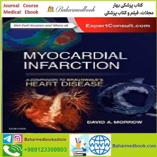 Myocardial Infarction A Companion to Braunwald's Heart Disease