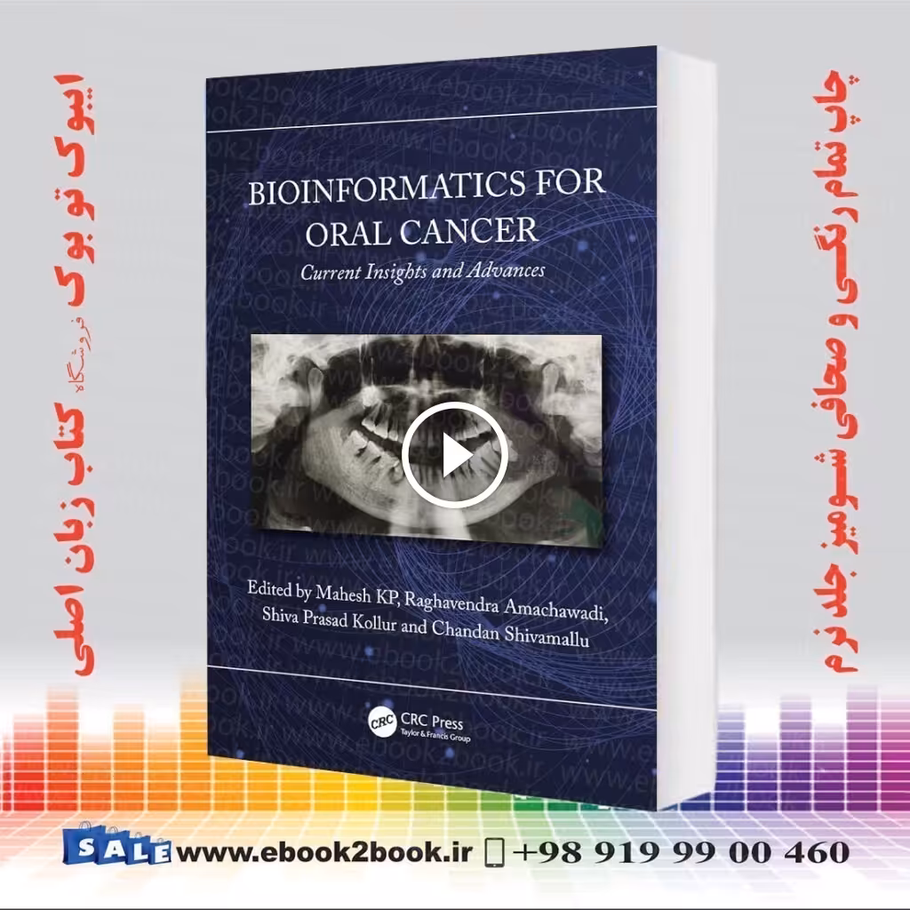 Bioinformatics for Oral Cancer: Current Insights and Advances