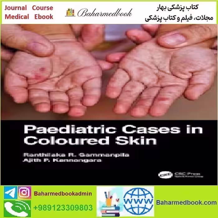 Paediatric Cases in Coloured Skin TRUE PDF price 1€ - کتاب پزشکی بهار
