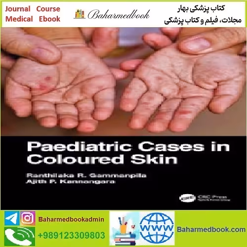 Paediatric Cases in Coloured Skin TRUE PDF price 1€ - کتاب پزشکی بهار