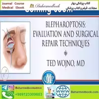QMP Blepharoptosis Evaluation and Surgical Repair