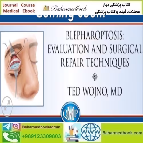 QMP Blepharoptosis Evaluation and Surgical Repair
